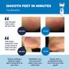 Electric Callus Remover: Own Harmony Professional Pedicure Tools Foot Care for Women, Rechargeable Foot Scrubber, CR900 Electronic Feet File Pedi Sander Best for Hard Cracked Dry Dead Skin, 3 Rollers view 2