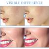 High Frequency Facial Machine - TUMAKOU Portable Handheld High Frequency Facial Skin Wand Machine with 4 Different Tubes view 4