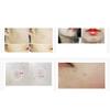TISHA AC7 Spot Anti-acne Serum, Brightening Moisturizing Troubled Skin, Acne Problem Solution, 15ML view 4