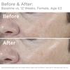 SkinMedica Total Defense + Repair SPF 34 Sunscreen for Face. This Lightweight, Facial Sunscreen is Ideal for Oily and/or Combination Skin, 2.3 Oz view 4