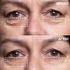 Wrinkles Schminkles Under Eye Patches - Rejuvenate Wrinkles with Medical Grade Silicone Reusable Anti-Wrinkle Patches for Under Eye Treatment, Banish Dark Circles (3 Pairs) view 3