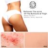 Anti-Acne Buttocks & Thigh Treatment- Clears Away Acne, Pimples, Zits, Dark Spots & Ingrown Hairs on the Buttocks &Thigh Area. Prevents Future Breakouts 6.9 OZ view 3