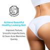 Anti-Acne Buttocks & Thigh Treatment- Clears Away Acne, Pimples, Zits, Dark Spots & Ingrown Hairs on the Buttocks &Thigh Area. Prevents Future Breakouts 6.9 OZ view 4